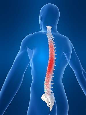 A hátfájás tünetei és kiváltó okai